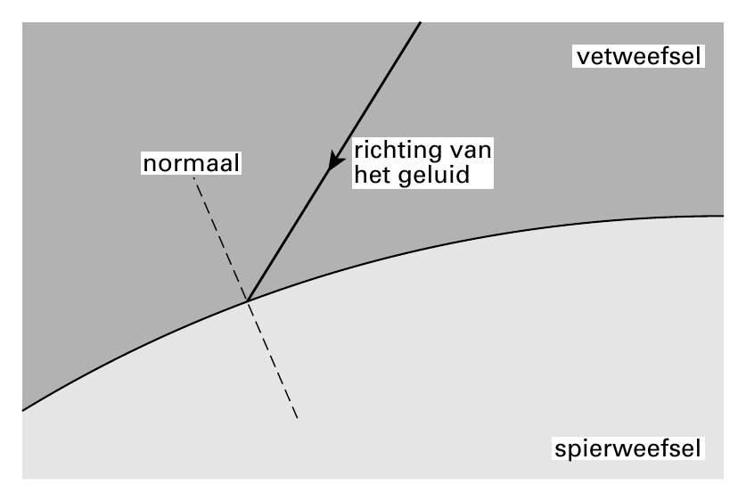 vetweefsel richting van normaal het geluid spierweefsel