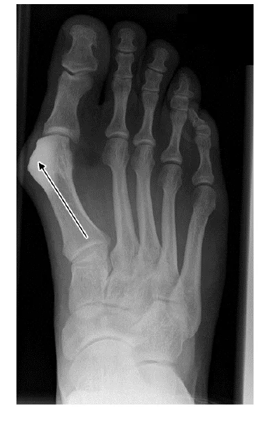 figuur 1 Figuur 1 is het resultaat van een CT-scan