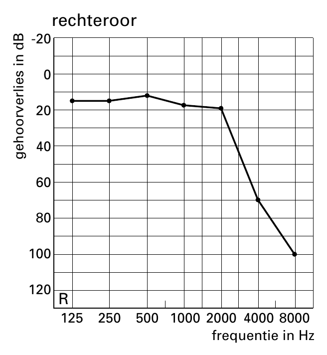 -20 0 20 40 60 80 100 120 Bd ni seilrevrooheg 125 250 500 1000 2000 4000 8000 frequentie in Hz rechteroor R