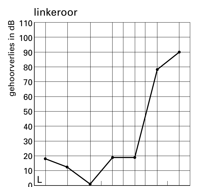 linkeroor 110 100 90 80 70 60 50 40 30 20 10 L Bd ni seilrevrooheg