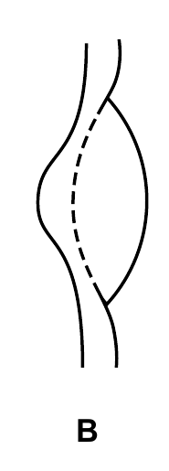 B